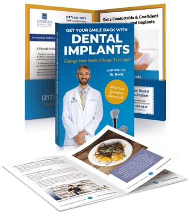 Preview for dental implants book by Springfield dentists