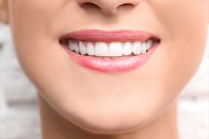 Springfield preventive dentistry Closeup of healthy smile