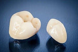 Two tooth-colored dental crowns on blue surface