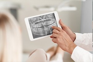 Digital dental x-rays on tablet computer