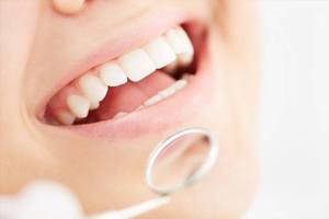 A closeup of a person’s mouth during a dental exam