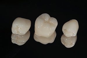 three dental crowns in Springfield on black background