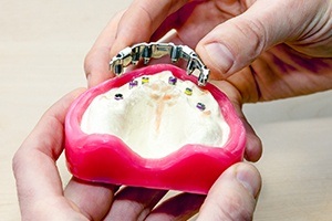 Model of implant denture base
