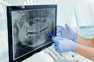 a dentist showing a patient their X-ray