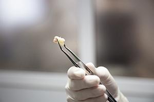 Dentist holding a tooth