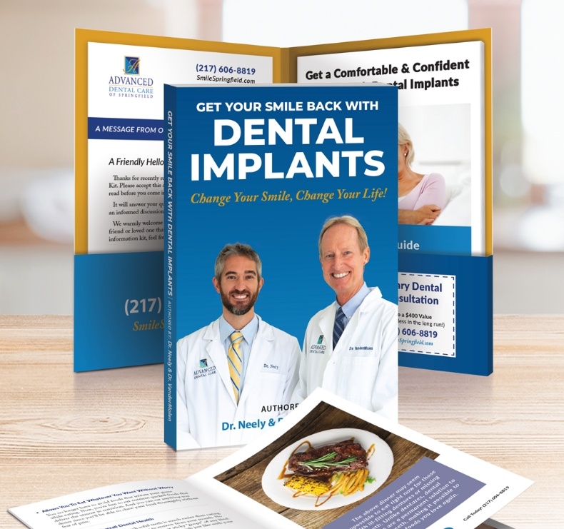 Dental implants book preview