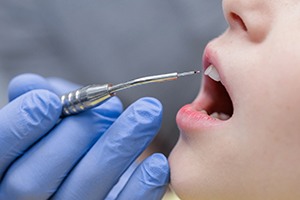 A patient getting laser gum disease treatment