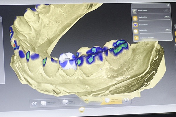 3d model of teeth