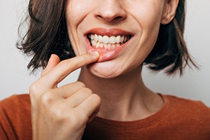 Woman pulling down lip to show gums