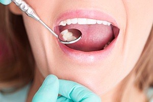 Woman receiving dental care