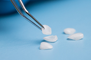 Veneers lying on a table