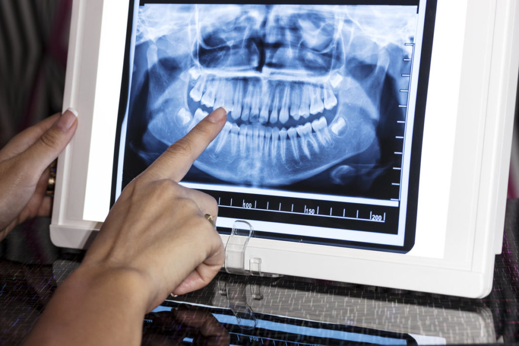 A dentist views a classic panoramic X-ray.