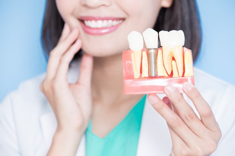 Woman with dental implant model