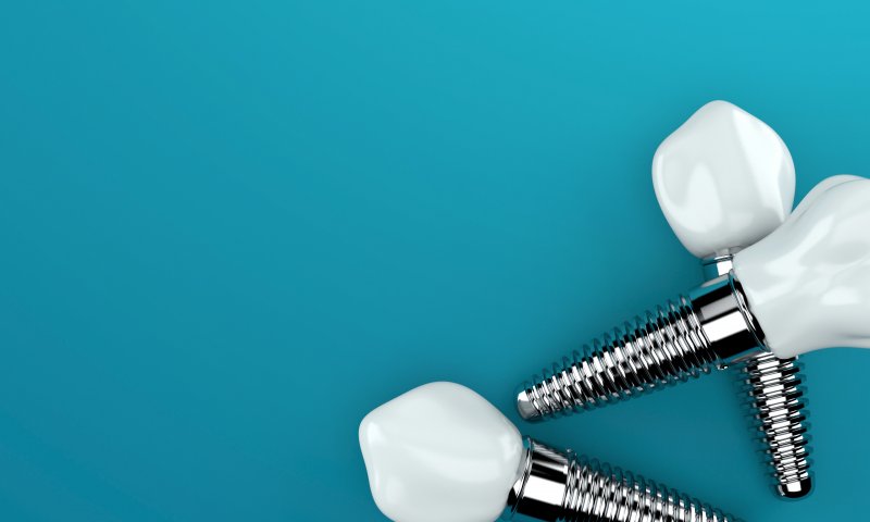 example of dental implants in Springfield