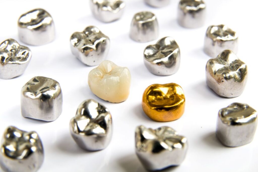 A variety of dental crowns made of different materials.