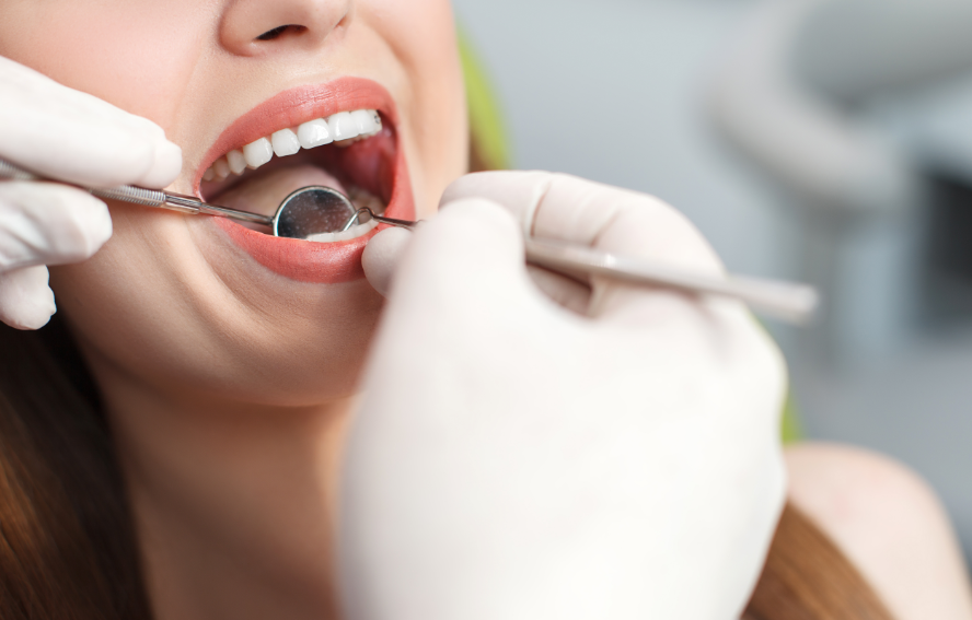 Close up of woman's mouth at dental exam