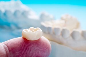 Dental crown on fingertip with model jaw in background